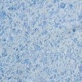Жидкие обои Silk Plaster Жидкие обои Жидкие обои Victoria 717, Голубой